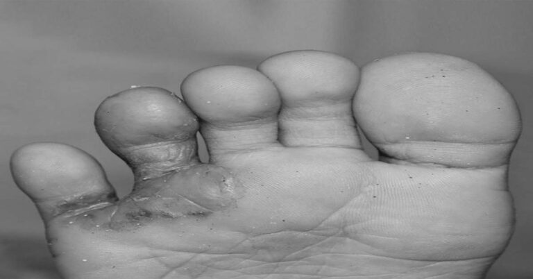 feet